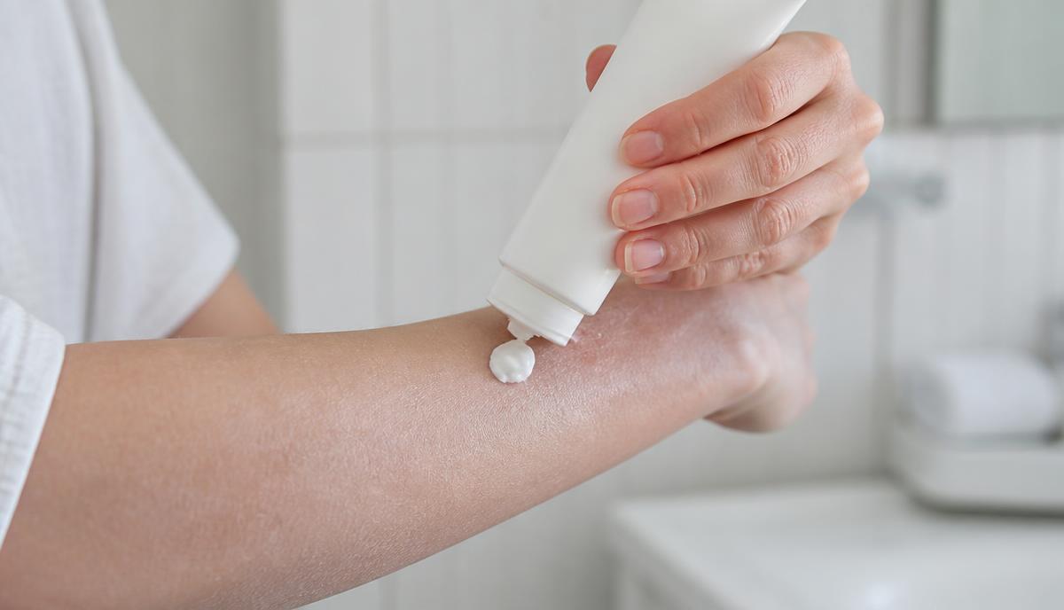 Eczema and dermatitis — everyday life photograph